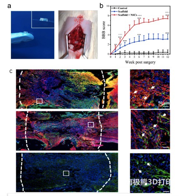 用于脊髓损伤修复的生物3D打印神经组织