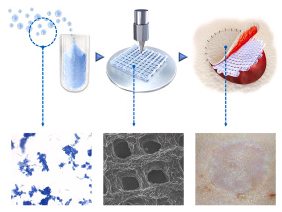 中山大学发表基于ECM的3D打印真皮研发新成果