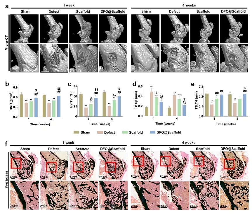 图2 功能性电纺纤维促进小鼠糖尿病股骨远端缺损修复 图2 功能性电纺纤维促进小鼠糖尿病股骨远端缺损修复
