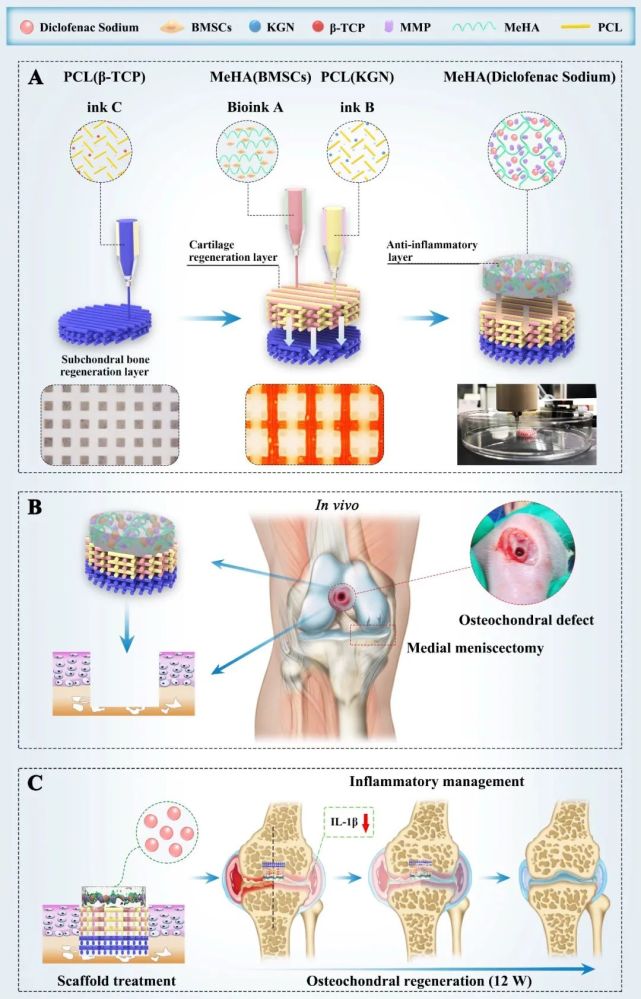 生物3D打印仿生支架促炎症环境下骨软骨缺损有效再生 生物3D打印仿生支架促炎症环境下骨软骨缺损有效再生