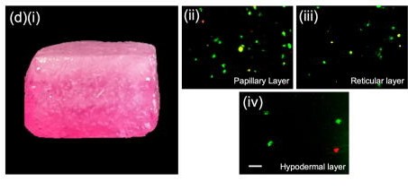 3D生物打印的皮肤(左) 3D生物打印的皮肤(左)