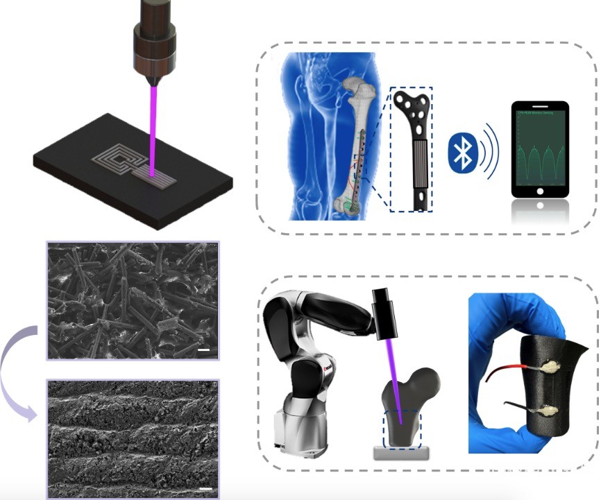 图1 基于激光直写的CFR-PEEK基智能骨科植入物 图1 基于激光直写的CFR-PEEK基智能骨科植入物