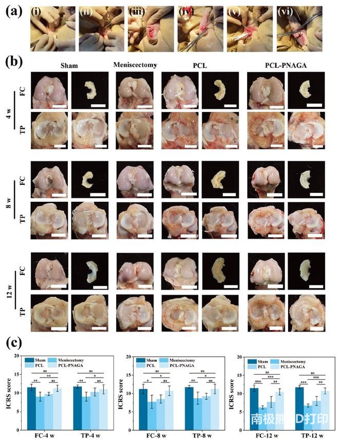 3D打印超高强度聚合物水凝胶,或可代替受损半月板 3D打印超高强度聚合物水凝胶,或可代替受损半月板