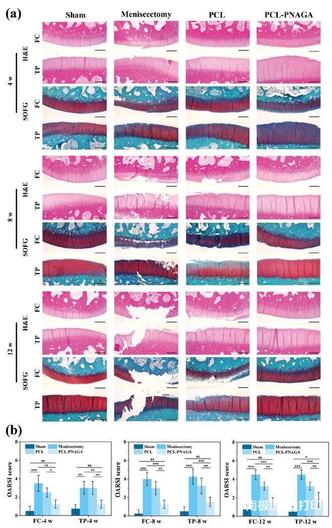 3D打印超高强度聚合物水凝胶,或可代替受损半月板 3D打印超高强度聚合物水凝胶,或可代替受损半月板