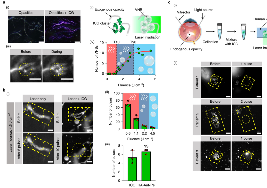 ICG 用于消除玻璃体混浊的体外表征 ICG 用于消除玻璃体混浊的体外表征