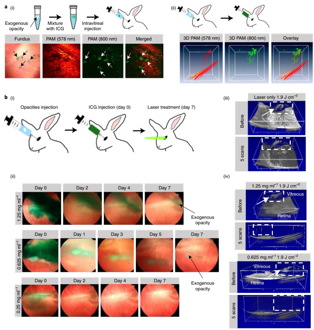 ICG 用于消除玻璃体混浊的体内表征 ICG 用于消除玻璃体混浊的体内表征