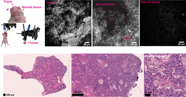 原位头颈部肿瘤共聚焦荧光内窥镜成像图及病理分析图