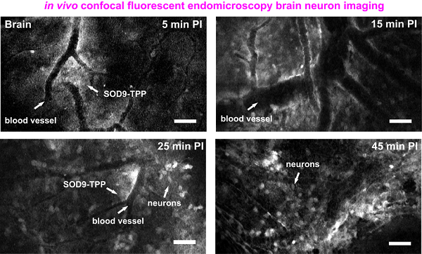 脑组织共聚焦荧光内窥镜成像图