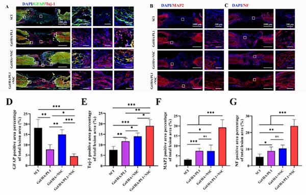 导电仿生支架促进脊髓损伤部位神经元再生