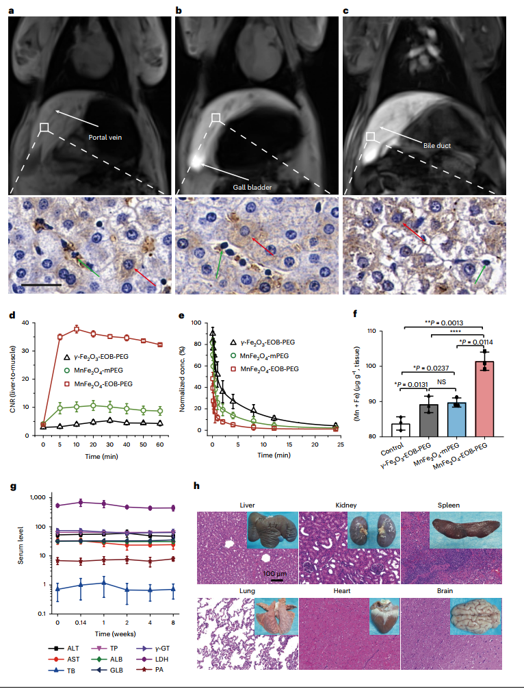猪体内肝细胞特异性磁共振成像和安全性评估
