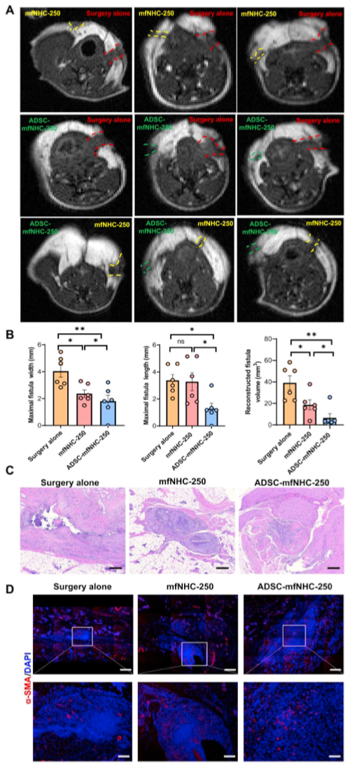 ADSC-mfNHC-250治疗大鼠CD-PAF的疗效