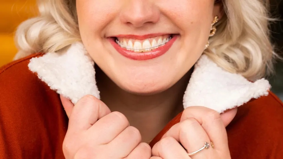 LightForce 是根据每个支架的形状和方向定制的 3D 打印陶瓷支架