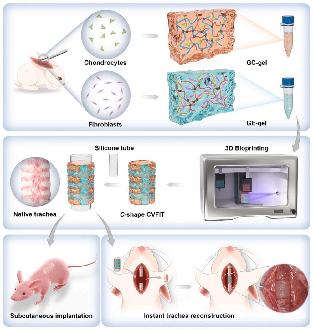 使用基于组织特异性基质水凝胶的 3D 生物打印 C 形软骨血管化纤维组织集成气管进行即时气管重建的示意图